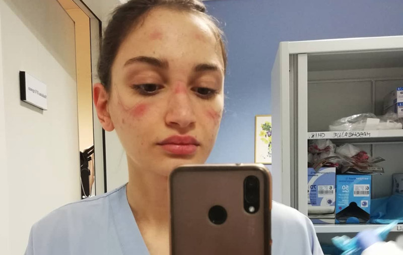 Tak wyglądają kobiety lekarze po kilkunastu godzinach ratowania życia [GALERIA]